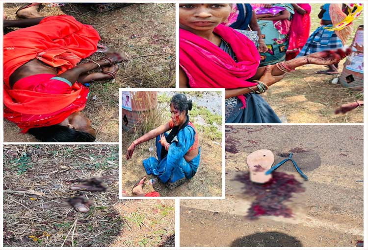 EXCLUSIVE : किसी की हाथ की अंगुलिया कटी किसी का फट गया सिर, बस्तर पण्डुम कार्यक्रम में भेड़-बकरियों की तरह भरकर ले जा रहे थे EXCLUSIVE : किसी की हाथ की अंगुलिया कटी किसी का फट गया सिर, बस्तर पण्डुम कार्यक्रम में भेड़-बकरियों की तरह भरकर ले जा रहे थे